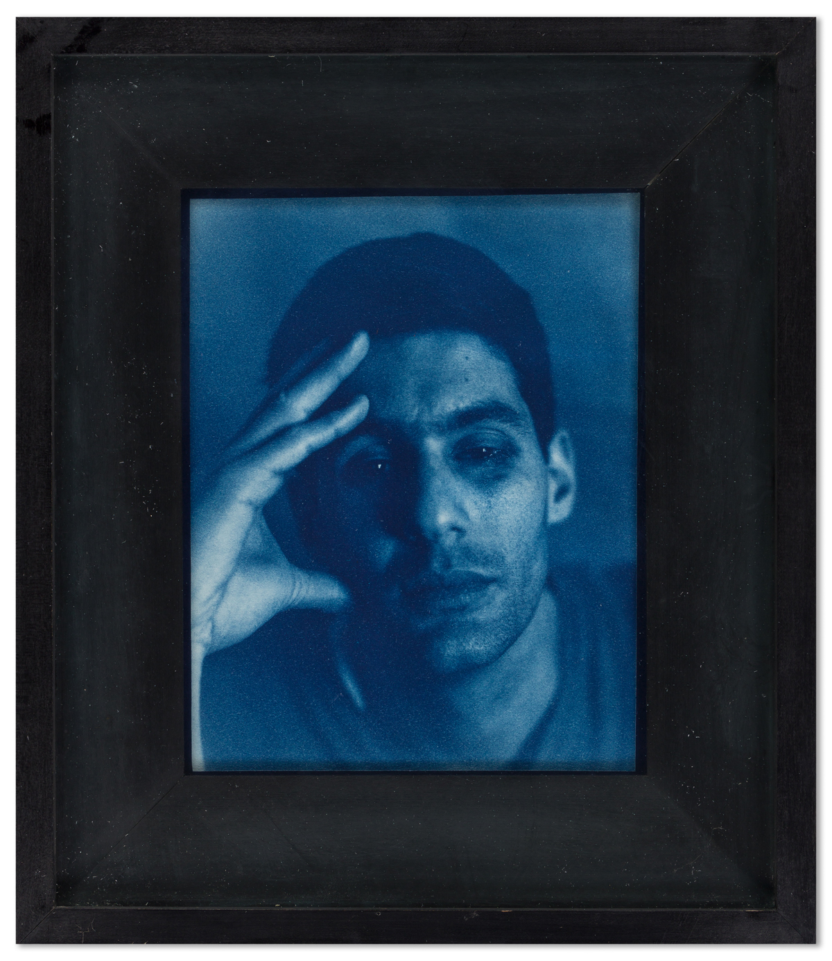 JOHN PATRICK DUGDALE (1960 - ) Self-portrait with Black Eye.